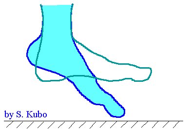 下垂足の図